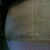 19 days PO of side... line on side from garment still swollen