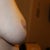right side pre op