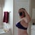 swelling of lower belly is still obvious