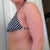 Pre op side view