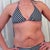Pre op bikini