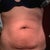 front view of baby belly (BEFORE)