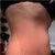 side view of baby belly (BEFORE)