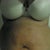 I am 1 week post opp and feeling a tad better,but gas is still killing me. My drains were removed at 6 days post opp.