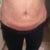 3days after!!