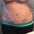 1 week PO. A lot less scary than day 3 photo.. Very swollen..