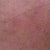 Needle marks or tattoo from where she injected still present  