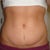 After - frontal