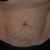 Before - Tummy Close Up. I think it looked like a Shar-Pei wrinkle dog's skin! :)