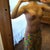 26 days post op