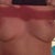 dabbed some cover up on the scars and you can barely see the incision lines