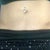 Stretch marks :/ and if you look closely you can see the incisions from the lipo right beside each hip bone.