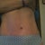 8 wks po