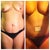 Before picture next to my day two post op picture.  I was SOOO proud of how low my doc. got the scar that I wanted to show her a picture at one my week post op visit.