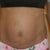 Before front
