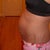 Before side