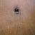 my belly button after stiches are off
