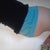 My new belly is really flat ! 27 days Post op Now weight:146 18lbs lost!