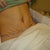 1 day PO. 1st dressing change and 1st view of new tummy.