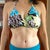 2 months PO - I'd say this is a radical change from my "before", thanks Dr. G!