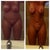 @1.5 months post op and now/-)