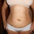 six weeks post op