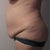2 months before, left side
