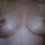3 weeks post op.  Overall, happy with look of incicions 3 weeks out and no scar treatment, etc. allowed yet.  Did alert my PS to the one red area of right breast next to incision and will keep an eye on it.  Think scars are going to heal nicely and the symmetry issue I was so woe=rried about is improving (except in next pic, which is a fluke cause of how I held arms when taking pic, I think).  One PS said I wouldn't be happy with upper fullness without implants and I am happy with overall shape.  Implants are good for some, but after years with DD breasts, I just wanted them smaller, not fuller :-)