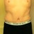 8 weeks post op - hiding the incision