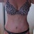 141 8 days post op