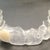 Invisalign tray #10 with Pontic
