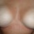 almost 1 month post op