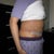 DAY 16 POST OP