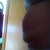 hernia and flap so sad