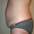 Left side is so much bigger than my right side