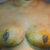 16 days post op