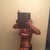 u can see the lump on my side where im still swollen from lipo of the flanks