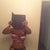 No Mt, just TT and full lipo on my stomach  and flanks..i didnt need it