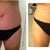 OMG   I love this !!!!   2 weeks exactly from surgery.  This is the first time I tried on my bathing suit.  I'm still super swollen, but man, this is gonna look GOOD !!!