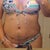 front view one week po