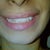 hardly can see my teeth on the right.. no laugh line.. :(