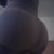 post op fullness YES!!!!!!!!!!!!!