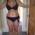 Before smart lipo