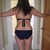 Before smart lipo