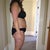 Before smart lipo