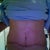 post up 10 weeks.  I think the Scar Fx sheets are working on the vertical scar