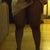 My legs four days later. My legs look better now but they're still swollen.