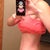 24 Days Postop - a little more swollen on this side than the other.  Was worried it was fat - PS laughed and said no, it is swelling :)