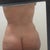 pre-op back
