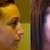 Before versus 2 months post op